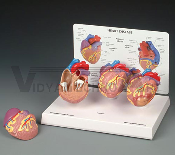 Heart Disease Model Pharmaceutical and Anatomical Model Gifts